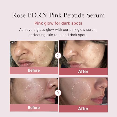 medicube PDRN Pink Peptide Serum, Pink glow serum, Peptide, Niacinamide, Hydrating & Moisturizing & Firming, Uneven Skin Tone, Korean Skincare | 1.01 fl.oz.